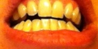 dents Apithérapie Miel Naturopathie Réflexologies Bien-être